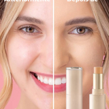 Βάση σε Stick Mate με Πλήρη Κάλυψη